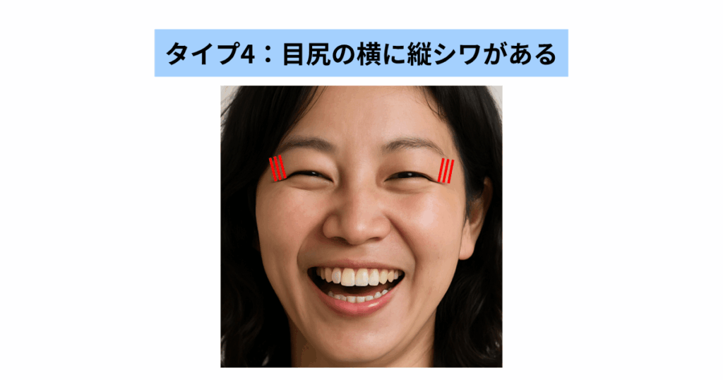 タイプ4:目尻の横に縦シワがある人相
