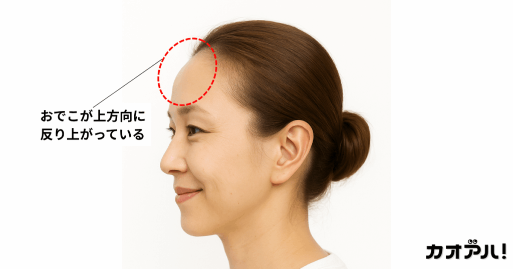 タイプ3.おでこが上方向に反り上がっている人相
